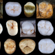 A sampling of some hominin teeth analyzed in the new study.